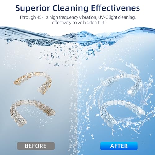 EcoBasic Ultrasonic Retainer Cleaner Review Deep Cleaning Denture Care with UV Technology EcoBasic Ultrasonic Retainer Cleaner Review Deep Cleaning Denture Care with UV Technology