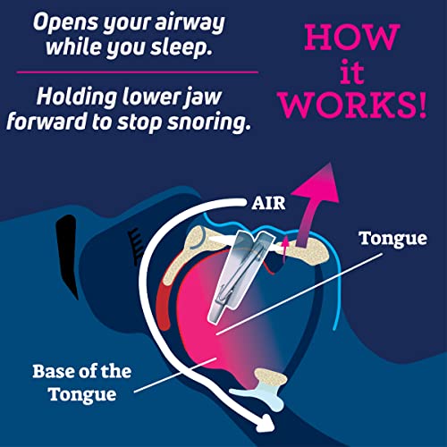 SmartGuard Anti-Snore Device Review Best Comfortable Adjustable Snore Reducing Mouthpiece